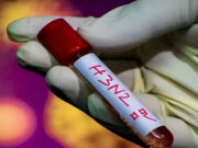 SEDES CONFIRMA CUATRO CASOS DE INFLUENZA A H3N2 VARIANTE K EN SANTA CRUZ