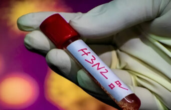 SEDES CONFIRMA CUATRO CASOS DE INFLUENZA A H3N2 VARIANTE K EN SANTA CRUZ