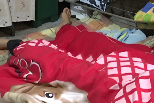 JOVEN QUEDA POSTRADO TRAS BRUTAL ATAQUE DE SU NOVIA CON UN MACHETE EN SANTA CRUZ