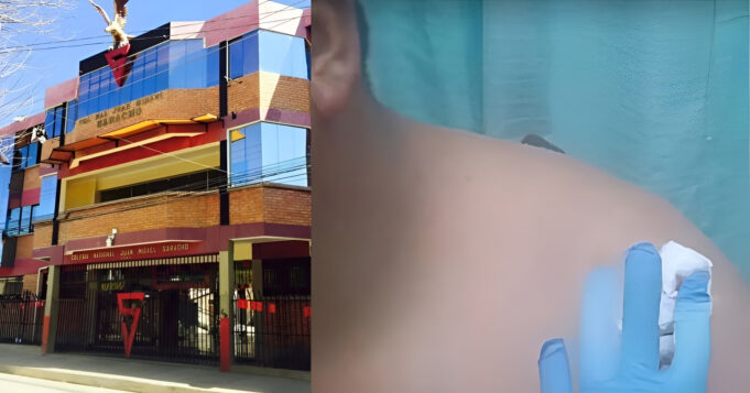 PROFESOR ES APUÑALADO POR SU ESTUDIANTE DE 15 AÑOS TRAS REUNIÓN POR BAJO RENDIMIENTO EN ORURO