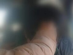JOVEN DE 20 AÑOS FUE HALLADO CORRIENDO CON UN CUCHILLO INCRUSTADO EN LA CABEZA EN LA PAZ